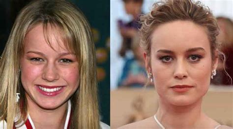 brie larson breast implants|Brie Larson Plastic Surgery